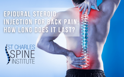 Epidural Steroid Injection for Back Pain: How Long Does It Last?