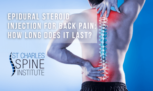 Epidural Steroid Injection For Back Pain How Long Does It Last St Charles Spine Institue