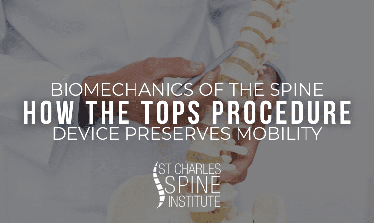 Biomechanics of the Spine- How the TOPS Device Preserves Mobility