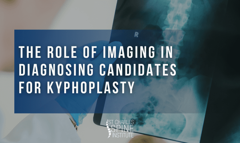 The Role of Imaging in Diagnosing Candidates for Kyphoplasty