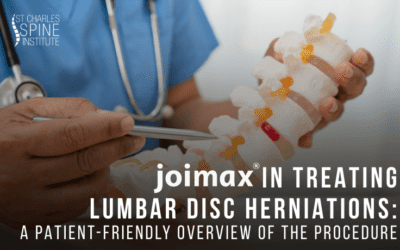 joimax® in Treating Lumbar Disc Herniations: A Patient-Friendly Overview of the Procedure