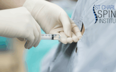 The Benefits of the TOPS Procedure Compared to Spinal Fusion